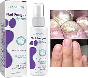 Powerful Antifungal Spray – Restore Your Nails Naturally